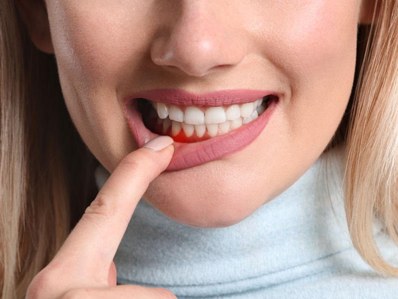 Periodontics